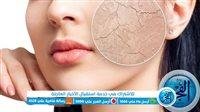 3 مكونات طبيعية تخلصك من جفاف البشرة في الصيف وتمنحكِ نعومة فائقة