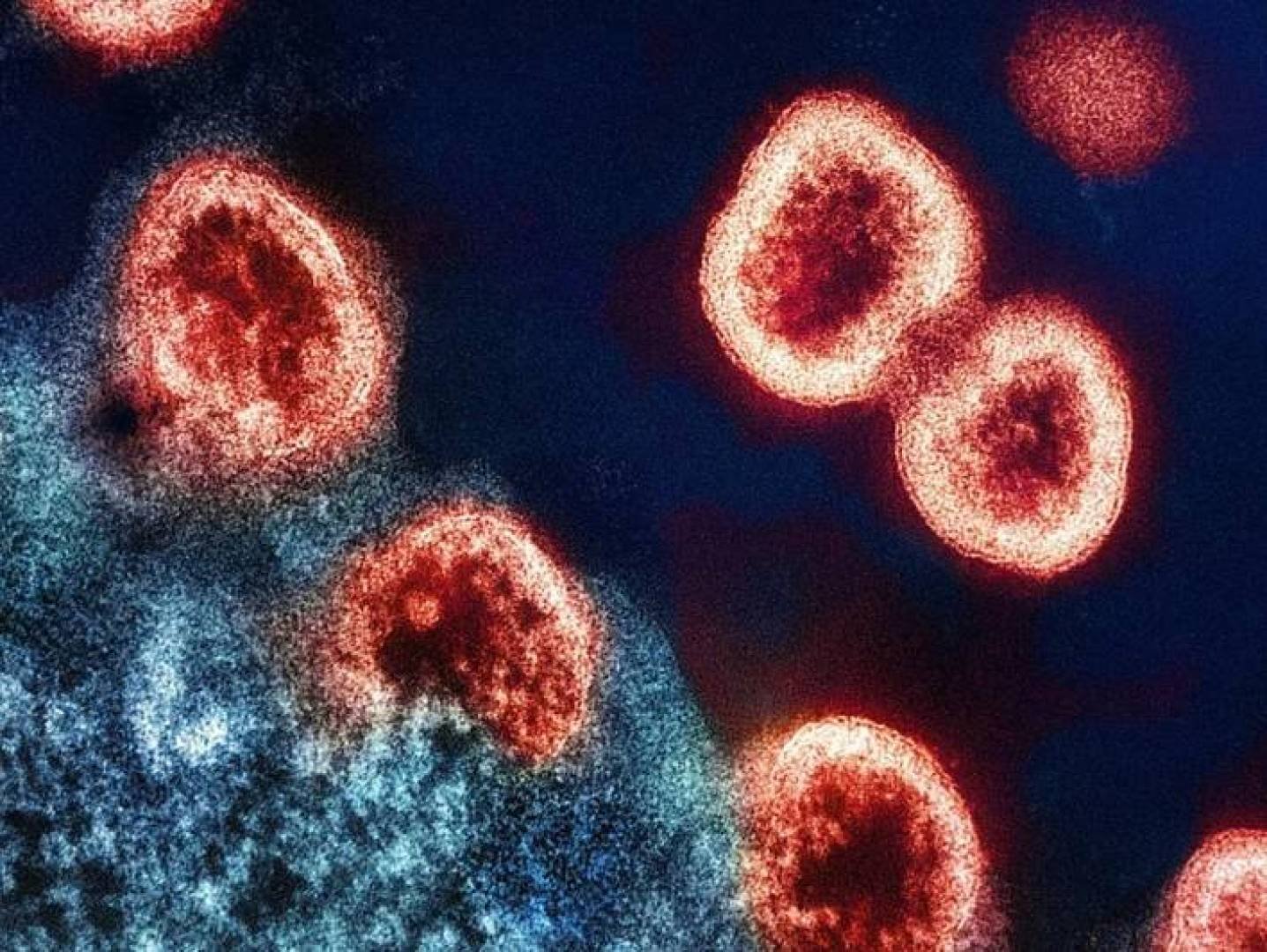 «ثورة علمية في مكافحة السرطان» علماء يتمكنون من تنمية خلايا مناعية جديدة لتعزيز الدفاعات الجسمية