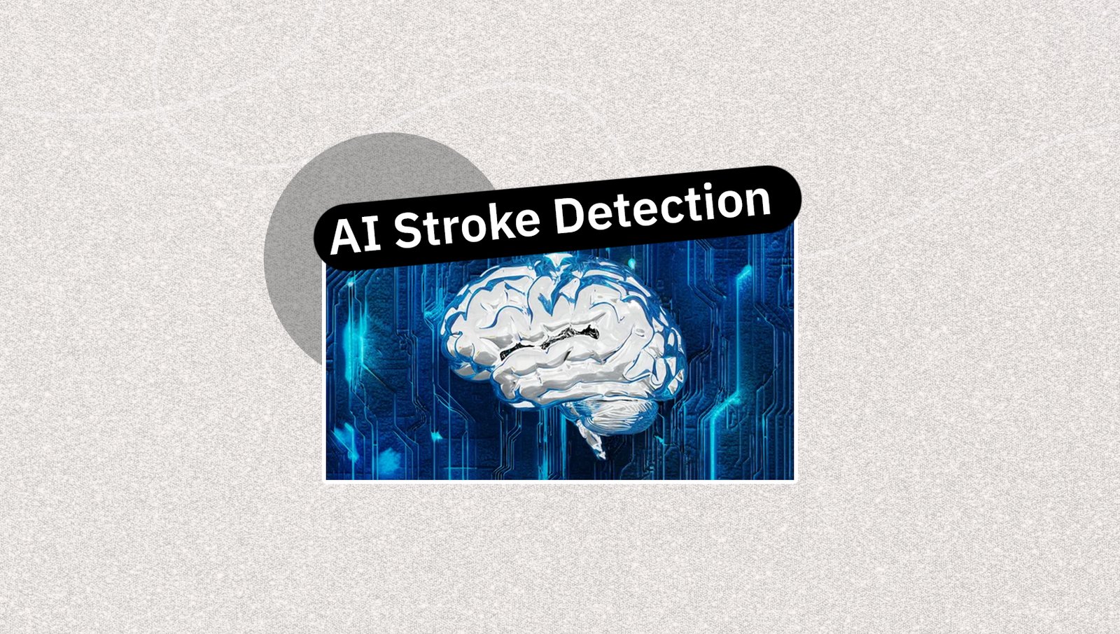 «تكنولوجيا مبتكرة تكشف الجلطات الدماغية مبكرًا باستخدام الأشعة المقطعية»