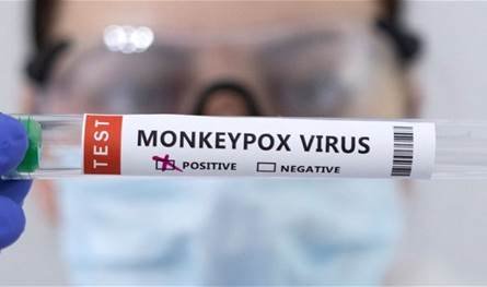 إصابة فرد بالسلالة الأكثر خطورة من جدري القرود في نيويورك وأبرز الأعراض المرتبطة بالفيروس