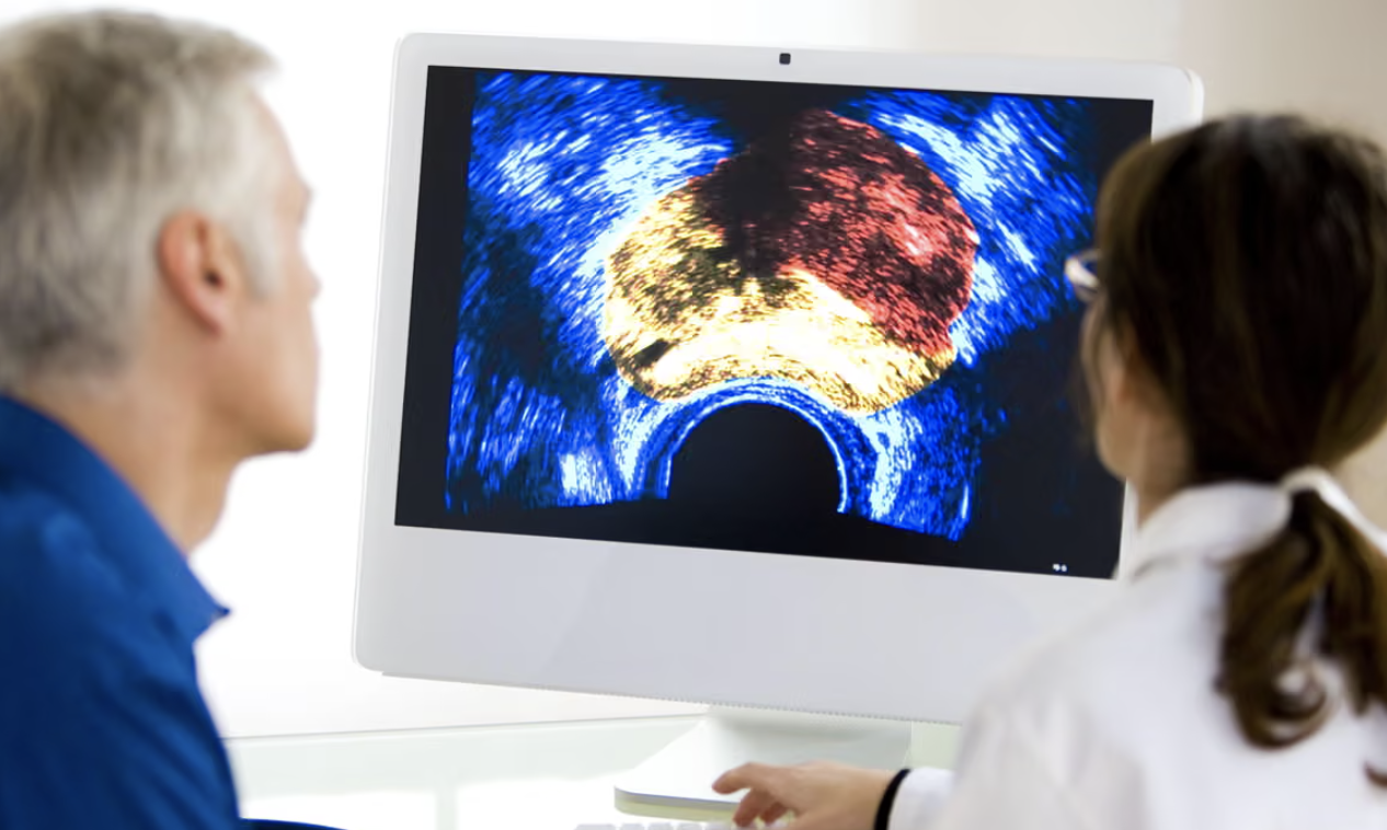 «تحسن ملحوظ» انخفاض معدل وفيات السرطان في بريطانيا بنسبة الثلث منذ الثمانينيات