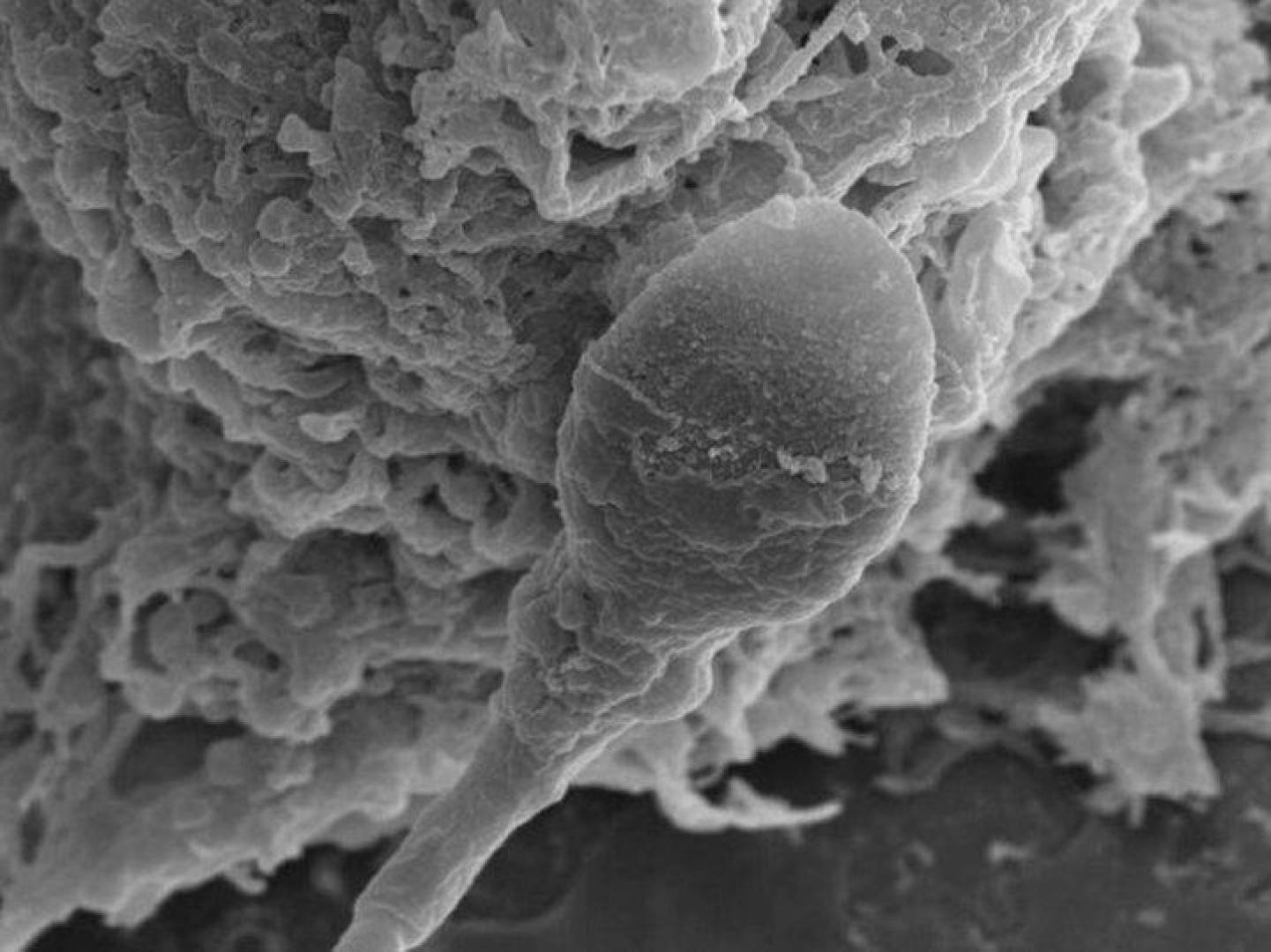 تأثير انعدام الجاذبية على حركة الحيوانات المنوية وقدرتها على التخصيب في الفضاء