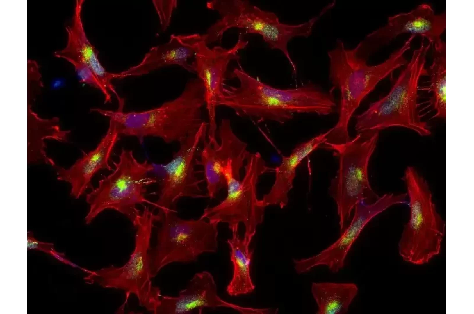 «ابتكار مادة ثلاثية الأبعاد تعزز نمو خلايا الدماغ وتواصلها في المختبر»